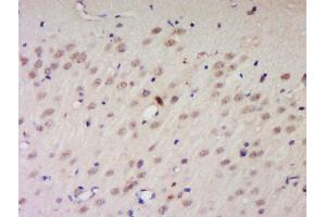 Formalin-fixed and paraffin embedded rat brain labeled with Anti-PNUTS/PPP1R10 Polyclonal Antibody, Unconjugated  at 1:200 followed by conjugation to the secondary antibody and DAB staining. (PPP1R10 anticorps  (AA 151-250))