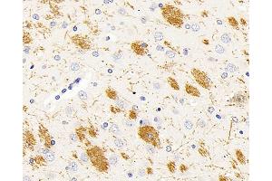 Immunohistochemistry analysis of paraffin-embedded rat brain using MBP Polyclonal Antibody at dilution of 1:500. (MBP anticorps)
