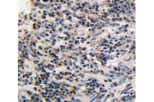 Used in DAB staining on fromalin fixed paraffin-embedded esophagus tissue (PPARG anticorps  (AA 149-273))