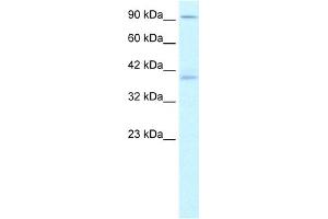 WB Suggested Anti-KIFC2 Antibody Titration:  1. (KIFC2 anticorps  (N-Term))