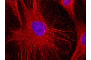 Immunofluorescence staining (mouse fibroblasts) Immunofluorescence staining of 3T3 mouse embryonal fibroblast cell line with anti-Vimentin (VI-01) Dyomics 547. (Vimentin anticorps)