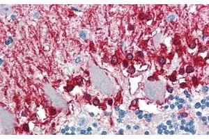 Detection of ALDH1A3 in Human Cerebellum Tissue using Polyclonal Antibody to Aldehyde Dehydrogenase 1 Family, Member A3 (ALDH1A3)
