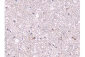 Detection of PC in Human Cerebrum Tissue using Polyclonal Antibody to Pyruvate Carboxylase (PC)