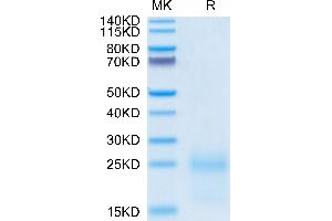 Cynomolgus TSLP on Tris-Bis PAGE under reduced condition.
