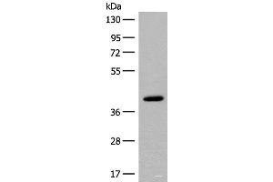 Western blot analysis of Human placenta tissue lysate using FCGRT Polyclonal Antibody at dilution of 1:400