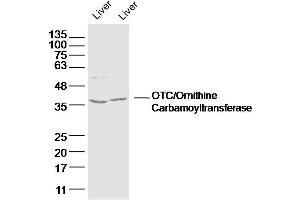 Lane 1: mouse iver lysates Lane 2: rat liver lysates probed with OTC/Ornithine Carbamoyltransferase Polyclonal Antibody, Unconjugated  at 1:300 dilution and 4˚C overnight incubation. (OTC anticorps  (AA 31-130))