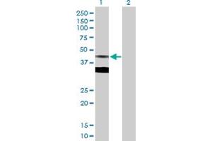 Western Blot analysis of FDPS expression in transfected 293T cell line by FDPS MaxPab polyclonal antibody. (FDPS anticorps  (AA 1-419))