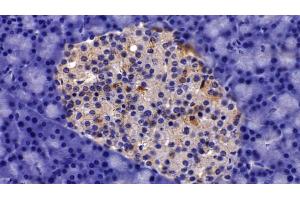 Detection of AST2 in Rat Pancreas Tissue using Polyclonal Antibody to Aspartate Aminotransferase 2 (AST2) (AST2 (AA 30-430) anticorps)