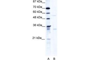 Western Blotting (WB) image for anti-TRIM17 / RNF16 (TRIM17) antibody (ABIN2460982) (TRIM17 / RNF16 anticorps)