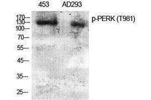 Western Blotting (WB) image for anti-Eukaryotic Translation Initiation Factor 2-alpha Kinase 3 (EIF2AK3) (pThr981) antibody (ABIN3179812) (PERK anticorps  (pThr981))