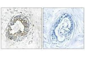 Immunohistochemistry analysis of paraffin-embedded human placenta tissue using PAK1/2 (Ab-199) antibody.