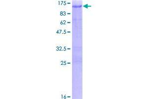 Image no. 1 for Aryl Hydrocarbon Receptor Nuclear Translocator (ARNT) (AA 1-789) protein (GST tag) (ABIN1345671)