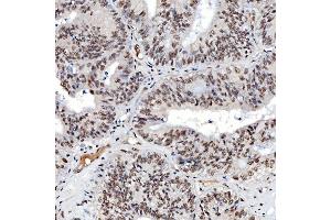 IHC analysis of SNRNP40 using anti-SNRNP40 antibody (ABIN7601719). (SNRNP40 anticorps  (AA 43-357))