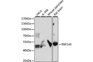 Western blot analysis of extracts of various cell lines, using RNF149 antibody (ABIN7270062) at 1:1000 dilution. (RNF149 anticorps  (AA 221-400))