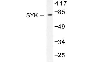 Image no. 1 for anti-Spleen tyrosine Kinase (SYK) antibody (ABIN271835) (SYK anticorps)
