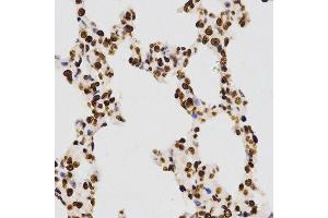 Immunohistochemistry of paraffin-embedded rat lung using DiMethyl-Histone H3-K27 antibody.