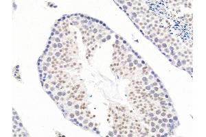 anti-Structure Specific Recognition Protein 1 (SSRP1) (Internal Region) antibody