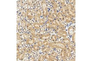 Immunohistochemistry of paraffin embedded mouse kidney using AZI2 (ABIN7072856) at dilution of 1:650 (300x lens)