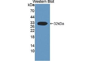 Detection of Recombinant CAPN3, Human using Polyclonal Antibody to Calpain 3 (CAPN3) (Calpain 3 anticorps  (AA 602-821))
