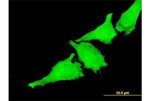 Immunofluorescence of monoclonal antibody to TAOK3 on HeLa cell. (TAO Kinase 3 anticorps  (AA 809-898))