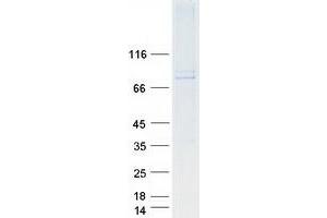 Validation with Western Blot