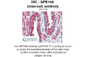 Image no. 2 for anti-G Protein-Coupled Receptor 146 (GPR146) (Internal Region) antibody (ABIN1734950) (GPR146 anticorps  (Internal Region))
