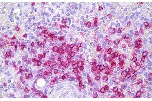 Anti-CD45RB antibody IHC staining of human spleen, lymphocytes. (CD45RB anticorps)