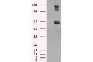 Image no. 1 for anti-Lipase, Endothelial (LIPG) antibody (ABIN1499168) (LIPG anticorps)