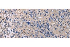 Immunohistochemistry of paraffin-embedded Human brain tissue using CHST3 Polyclonal Antibody at dilution of 1:35(x200) (CHST3 anticorps)