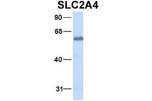 Host:  Rabbit  Target Name:  SLC2A4  Sample Type:  Human Fetal Heart  Antibody Dilution:  1. (GLUT4 anticorps  (N-Term))