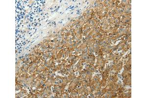 Immunohistochemistry (IHC) image for anti-Solute Carrier Family 16, Member 1 (Monocarboxylic Acid Transporter 1) (SLC16A1) antibody (ABIN3017184)