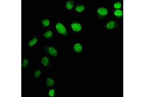 Immunofluorescence staining of Hela cells with ABIN7139603 at 1:12. (HIST1H1C anticorps  (meLys45))