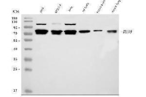 Western blot analysis of BRD9 using anti-BRD9 antibody (ABIN7602322).