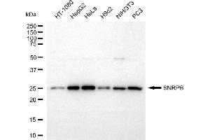 Western blotting analysis using SNRPB antibody (ABIN7800381).