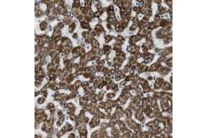 Immunohistochemical staining of human liver with MARC2 polyclonal antibody  shows strong cytoplasmic positivity in hepatocytes. (MARC2 anticorps)