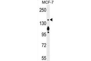Western Blotting (WB) image for anti-Myosin VI (MYO6) antibody (ABIN5015885) (Myosin VI anticorps)