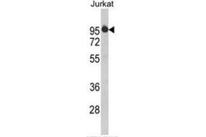 Western blot analysis of HTATSF1 Antibody (N-term) in Jurkat cell line lysates (35ug/lane). (HTATSF1 anticorps  (N-Term))