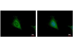 ICC/IF Image HSD17B4 antibody detects HSD17B4 protein at cytoplasm by immunofluorescent analysis.