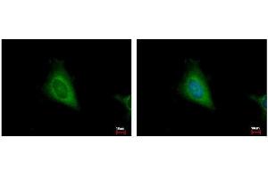 ICC/IF Image HSD17B4 antibody detects HSD17B4 protein at cytoplasm by immunofluorescent analysis. (HSD17B4 anticorps  (N-Term))