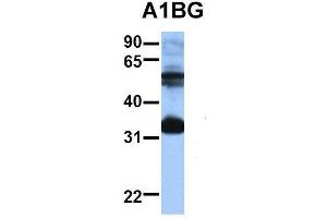 Host:  Rabbit  Target Name:  A1BG  Sample Type:  Jurkat  Antibody Dilution:  1.
