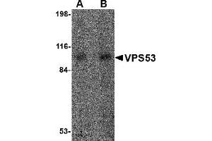 Western Blotting (WB) image for anti-Vacuolar Protein Sorting 53 Homolog (VPS53) (Middle Region) antibody (ABIN1031162)