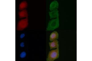 ABIN6257878 and ABIN6275516 staining Hela cells by IF/ICC.
