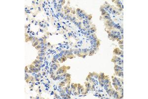 Immunohistochemistry of paraffin-embedded mouse lung using LRG1 antibody at dilution of 1:100 (40x lens). (LRG1 anticorps)