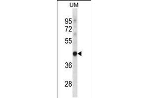 Western blot analysis in uterus tumor cell line lysates (35ug/lane). (TRUB1 anticorps  (AA 152-180))
