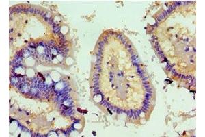 Immunohistochemistry of paraffin-embedded human small intestine tissue using ABIN7173812 at dilution of 1:100