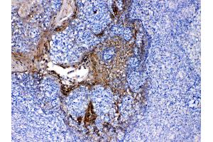 Periplakin was detected in paraffin-embedded sections of human tonsil tissues using rabbit anti- Periplakin Antigen Affinity purified polyclonal antibody (Catalog # ) at 1 µg/mL.