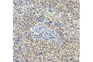IHC analysis of DDX1 using anti-DDX1 antibody (ABIN7602052).