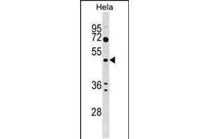 Western blot analysis in Hela cell line lysates (35ug/lane). (ALG2 anticorps  (AA 254-282))