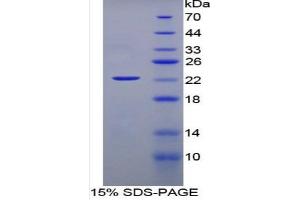 SDS-PAGE of Protein Standard from the Kit (Highly purified E.