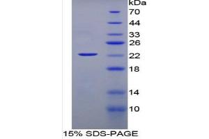 SDS-PAGE of Protein Standard from the Kit (Highly purified E. (IFNA Kit ELISA)